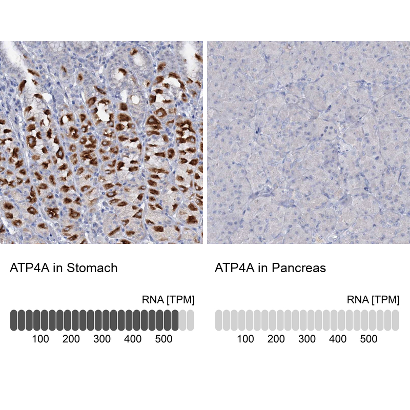 Anti-ATP4A Antibody