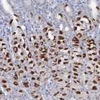 Immunohistochemical staining of human stomach shows high expression.