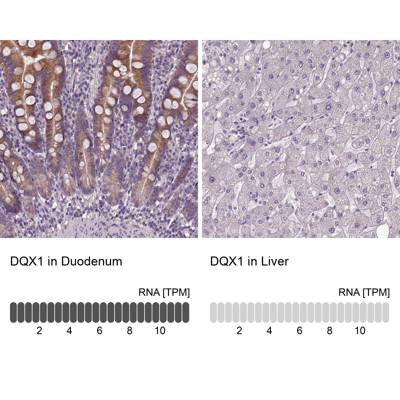 Anti-DQX1 Antibody