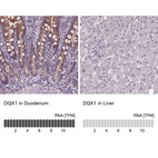 Anti-DQX1 Antibody