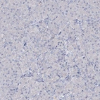 Immunohistochemical staining of human pancreas shows low expression as expected.