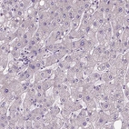 Immunohistochemical staining of human liver shows low expression as expected.