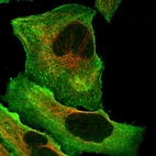 Immunofluorescent staining of human cell line U-2 OS shows localization to plasma membrane & cytosol.