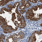 Anti-GADL1 Antibody