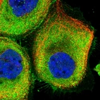 Immunofluorescent staining of human cell line A-431 shows localization to plasma membrane & cytosol.
