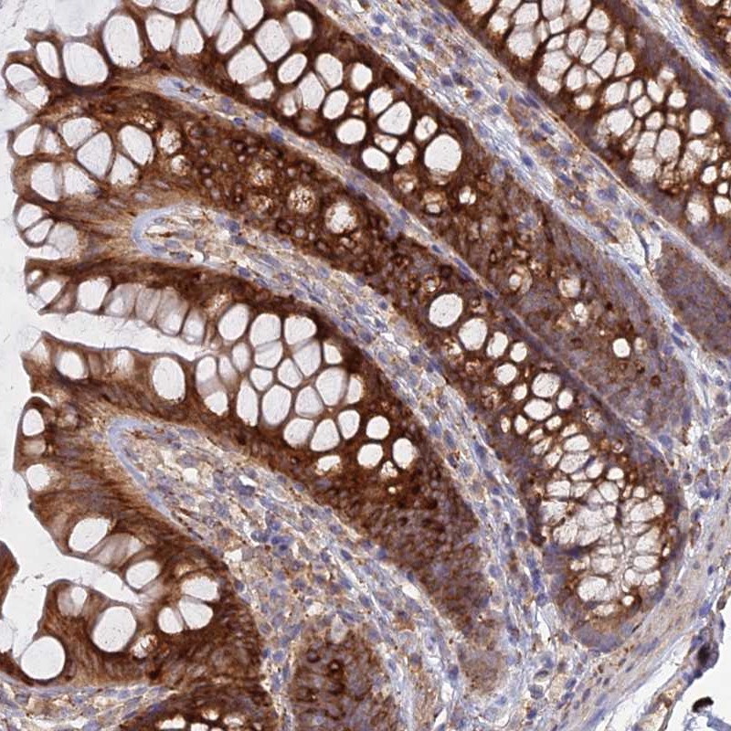 Anti-PPIC Antibody