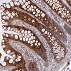 Anti-PPIC Antibody