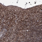 Immunohistochemical staining of human tonsil shows strong nuclear positivity in squamous epithelial cells.
