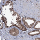 Immunohistochemical staining of human prostate shows strong nuclear positivity in glandular cells.