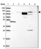 Anti-PHC3 Antibody