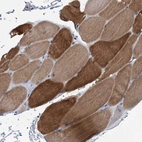 Immunohistochemical staining of human skeletal muscle shows high expression.