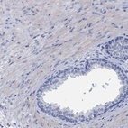 Immunohistochemical staining of human prostate shows low expression as expected.