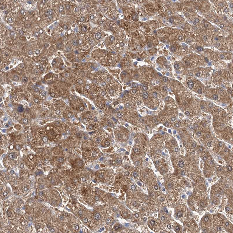 Anti-IDI1 Antibody