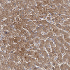 Anti-IDI1 Antibody