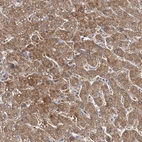 Anti-IDI1 Antibody