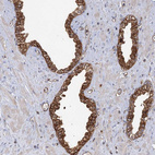 Immunohistochemical staining of human prostate shows strong cytoplasmic positivity in glandular cells.