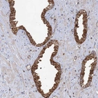 Immunohistochemical staining of human prostate shows strong cytoplasmic positivity in glandular cells.