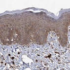 Immunohistochemical staining of human skin shows strong cytoplasmic positivity in squamous epithelial cells.