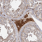 Immunohistochemical staining of human testis shows strong cytoplasmic positivity in Leydig cells.