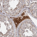 Immunohistochemical staining of human testis shows strong cytoplasmic positivity in Leydig cells.