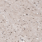 Anti-OTUB1 Antibody