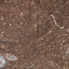 Immunohistochemical staining of human tonsil shows moderate nuclear and cytoplasmic positivity in germinal and non-germinal center cells.