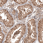 Anti-OTUB1 Antibody