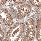 Immunohistochemical staining of human testis shows moderate nuclear and cytoplasmic positivity in cells in seminiferous ducts.