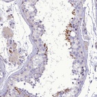 Anti-FAM149B1 Antibody