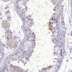 Anti-FAM149B1 Antibody