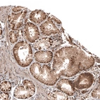 Immunohistochemical staining of human small intestine shows moderate nuclear positivity in glandular cells.