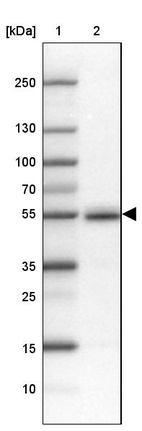 Lane 1: Marker [kDa] 250, 130, 100, 70, 55, 35, 25, 15, 10_br/_Lane 2: Human Testis tissue