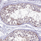 Anti-LATS2 Antibody