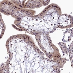 Immunohistochemical staining of human placenta shows weak to moderate nuclear and cytoplasmic positivity in trophoblastic cells.