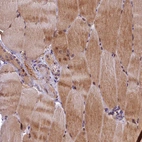 Immunohistochemical staining of human skeletal muscle shows weak to moderate nuclear and cytoplasmic positivity in myocytes.