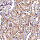 Immunohistochemical staining of human kidney shows weak to moderate nuclear and cytoplasmic positivity in cells in tubules.