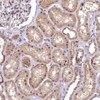 Immunohistochemical staining of human kidney shows weak to moderate nuclear and cytoplasmic positivity in cells in tubules.