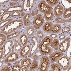 Anti-NUDT6 Antibody