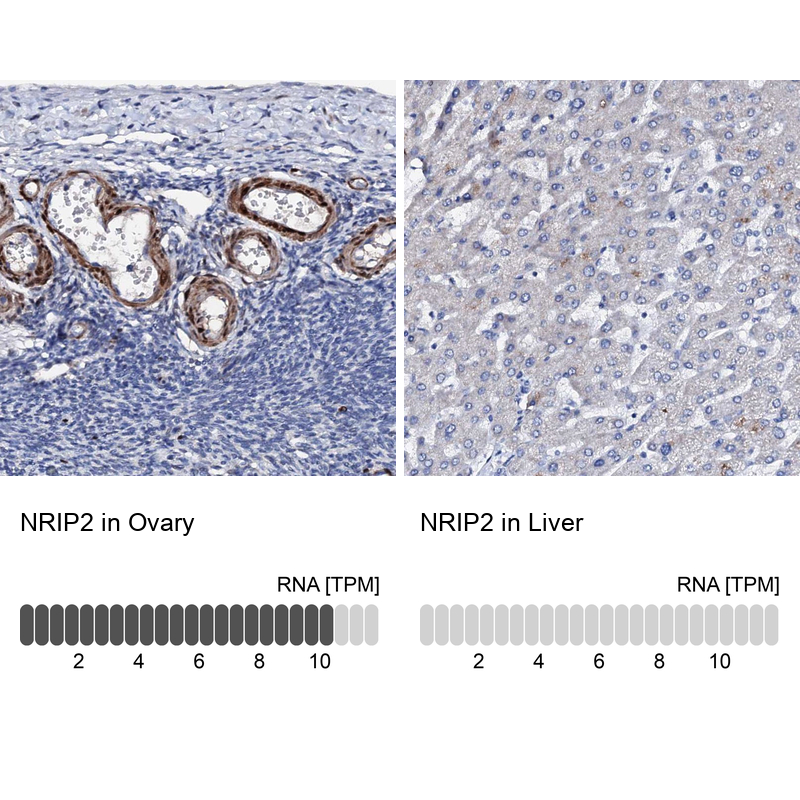 Anti-NRIP2 Antibody