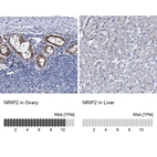 Anti-NRIP2 Antibody