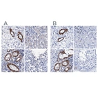 Immunohistochemical staining of human colon, liver, ovary and testis using Anti-NRIP2 antibody HPA039197 (A) shows similar protein distribution across tissues to independent antibody HPA039860 (B).