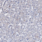 Immunohistochemical staining of human liver shows low expression as expected.
