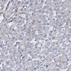 Immunohistochemical staining of human liver shows low expression as expected.