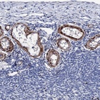Immunohistochemical staining of human ovary shows high expression.