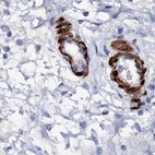 Immunohistochemical staining of human colon using Anti-NRIP2 antibody HPA039197.