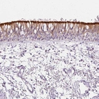 Immunohistochemical staining of human bronchus shows strong membranous positivity in respiratory epithelial cells.