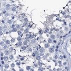 Immunohistochemical staining of human testis using Anti-NRIP2 antibody HPA039197.
