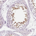 Immunohistochemical staining of human testis shows moderate cytoplasmic positivity in cells in seminiferous ducts.