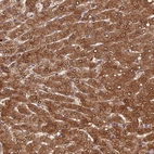 Anti-FUOM Antibody