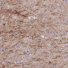 Anti-FRA10AC1 Antibody
